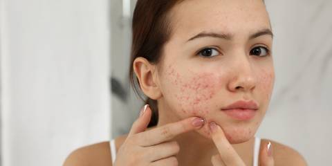 a girl looking in the mirror while popping pimples