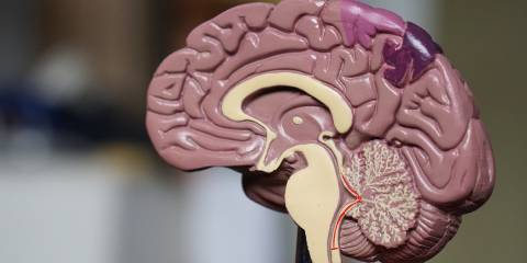 a model of a brain