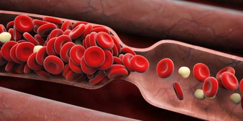 an illustration of a blood clot