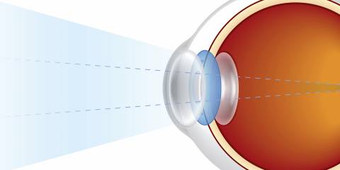 a diagram of the lens mechanism of the eye
